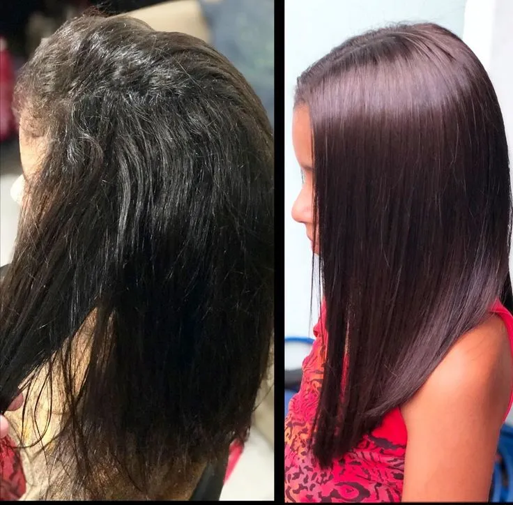 Progressiva, Botox, Escova